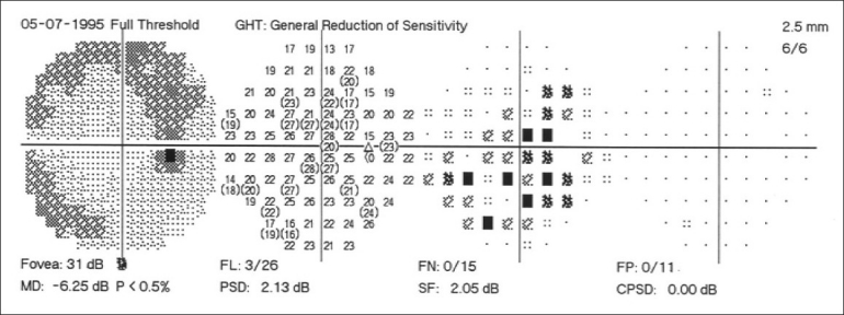 Figure 18