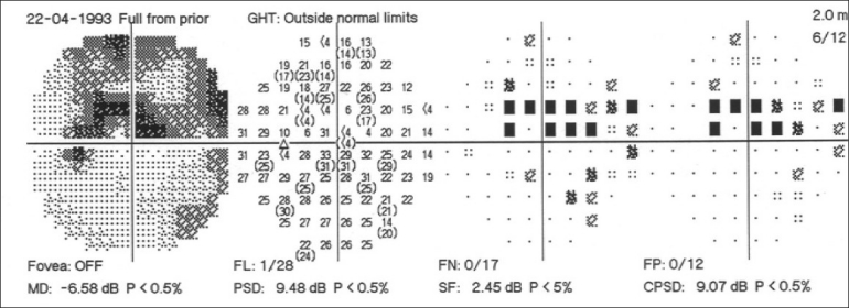 Figure 17