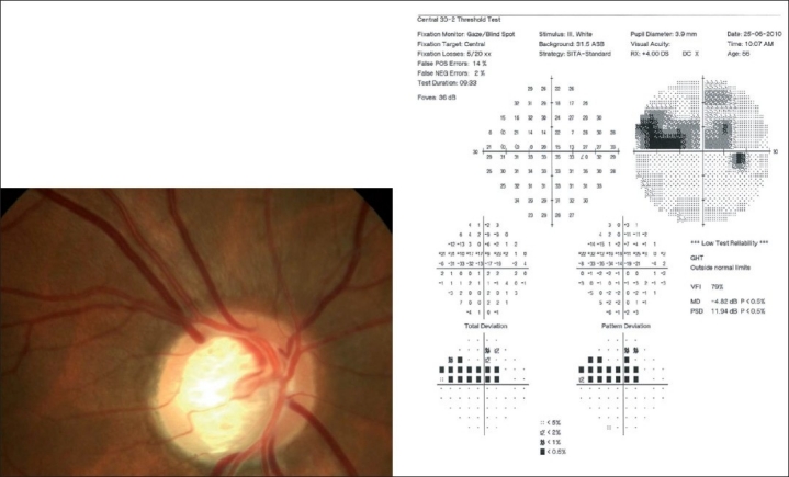 Figure 11