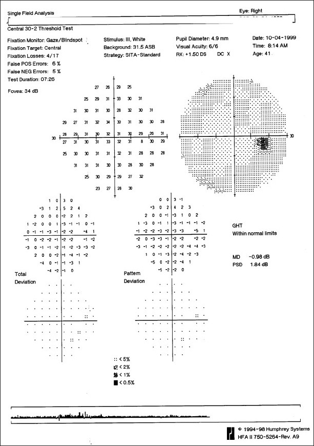 Figure 16