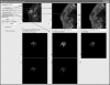 Fig 8.