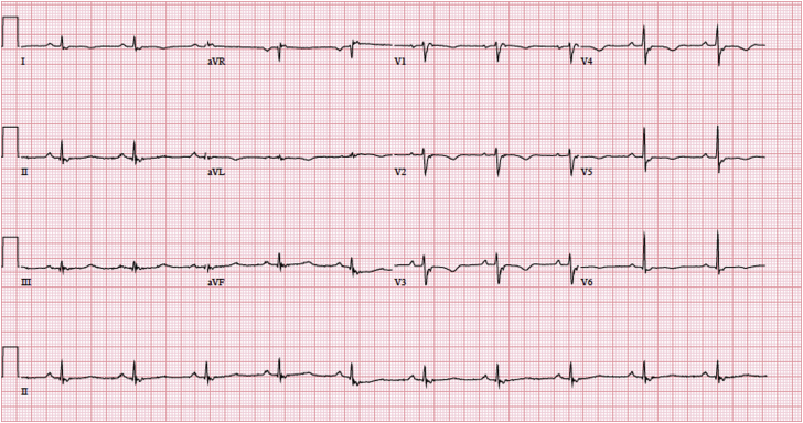 Figure 1