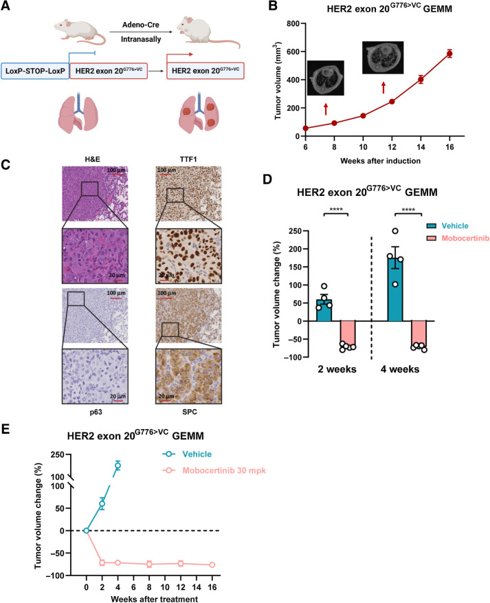 Figure 2. HER2 exon 20G776>VC GEMM showed sustained response to mobocertinib. A, Working model of genetically engineered mice with HER2 exon 20G776>VC insertion mutation using the LoxP-STOP-LoxP system. B, Different time points of tumor volume quantification on MRI of HER2 exon 20G776>VC–mutant mice after induction. C, Representative image of hematoxylin and eosin (H&E) staining and immunochemistry of TTF1, p63, and SPC on HER2 exon 20G776>VC–mutant tumors. D, Dot plot of tumor volume changes on MRI from HER2 exon 20G776>VC insertion–mutant GEMMs treated with mobocertinib for 2 and 4 weeks. E, Tumor volume change for up to 16 weeks on MRI from HER2 exon 20G776>VC insertion–mutant GEMMs treated with mobocertinib. ****, P < 0.0001.