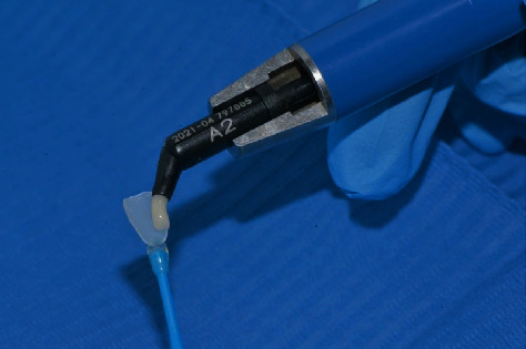 Figure 11