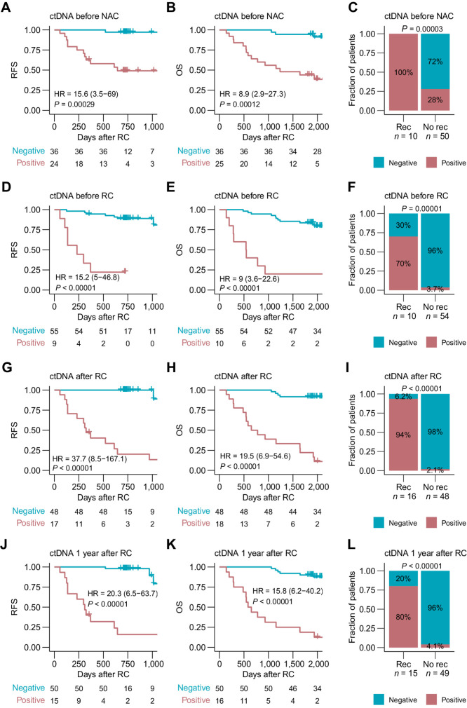 Figure 1. ctDNA detection for prognosis assessment in patients treated with NAC. A, Kaplan–Meier survival analysis of RFS and plasma ctDNA status before NAC. B, Kaplan–Meier survival analysis of OS and plasma ctDNA status before NAC. C, Association between plasma ctDNA status before NAC and recurrence status within 1 year after RC including only patients with at least 1 year of follow-up after RC. D, Kaplan–Meier survival analysis of RFS and plasma ctDNA status before RC. E, Kaplan–Meier survival analysis of OS and plasma ctDNA status before RC. F, Association between plasma ctDNA status before RC and recurrence status within 1 year after RC including only patients with at least 1 year of follow-up after RC. G, Kaplan–Meier survival analysis of RFS and accumulated plasma ctDNA status after RC. H, Kaplan–Meier survival analysis of OS and accumulated plasma ctDNA status after RC. I, Association between accumulated plasma ctDNA status after RC and recurrence. Recurrence was defined as detection of clinical recurrence from radiographic imaging results up to 2 years after the last plasma sample was analyzed. No recurrence was defined as absence of clinical recurrence during the surveillance period of up to 2 years after the last plasma sample was analyzed, including only patients with at least 2 years of follow-up after RC. J, Kaplan–Meier survival analysis of RFS and accumulated plasma ctDNA status within 1 year after RC. K, Kaplan–Meier survival analysis of OS and accumulated plasma ctDNA status within 1 year after RC. L, Association between accumulated plasma ctDNA status within 1 year after RC and recurrence. Recurrence was defined as detection of clinical recurrence from radiographic imaging results up to 2 years after the last plasma sample was analyzed (the last plasma sample within the 1-year time period after RC). No recurrence was defined as absence of clinical recurrence during the surveillance period of up to 2 years after the last plasma sample was analyzed, including only patients with at least 2 years of follow-up after RC. HRs, associated 95% CIs, and P values are displayed on each Kaplan–Meier plot (Cox regression analysis). Significant statistical difference between ctDNA status and recurrence was determined using Fisher exact test.