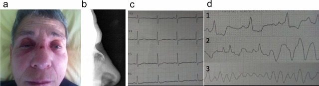 Figure 1