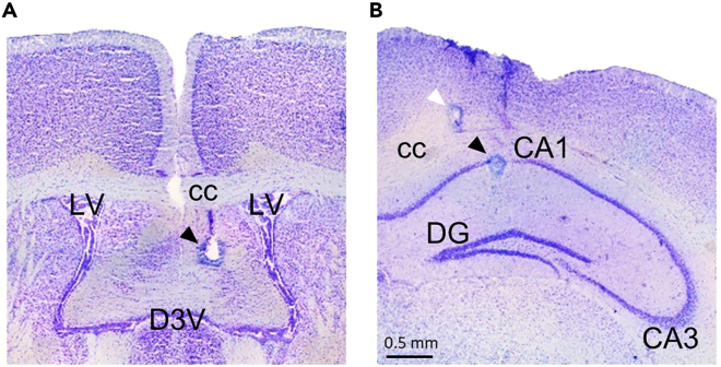 Figure 11