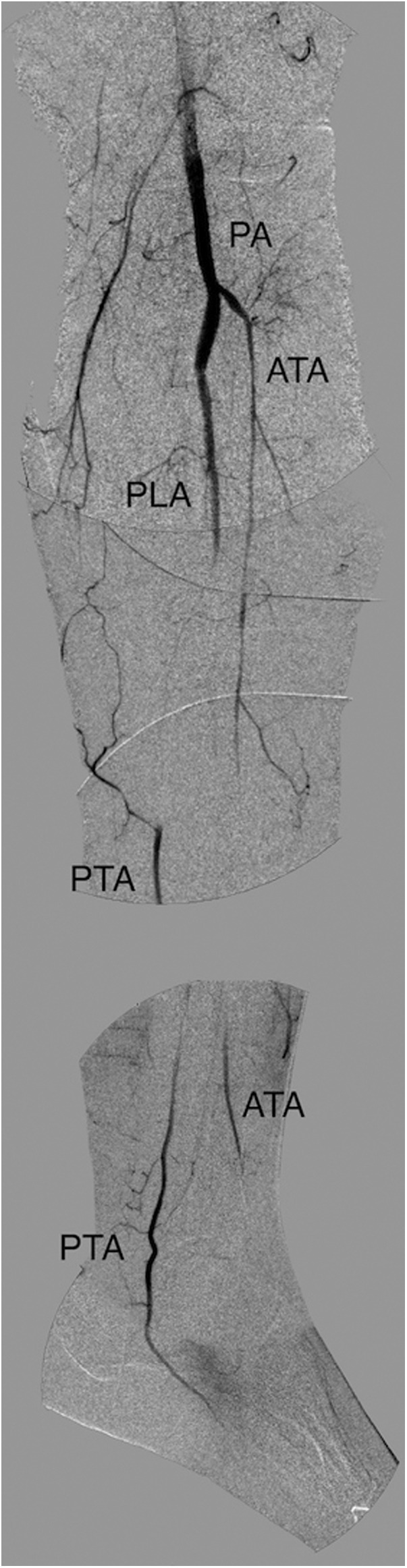 Fig. 2