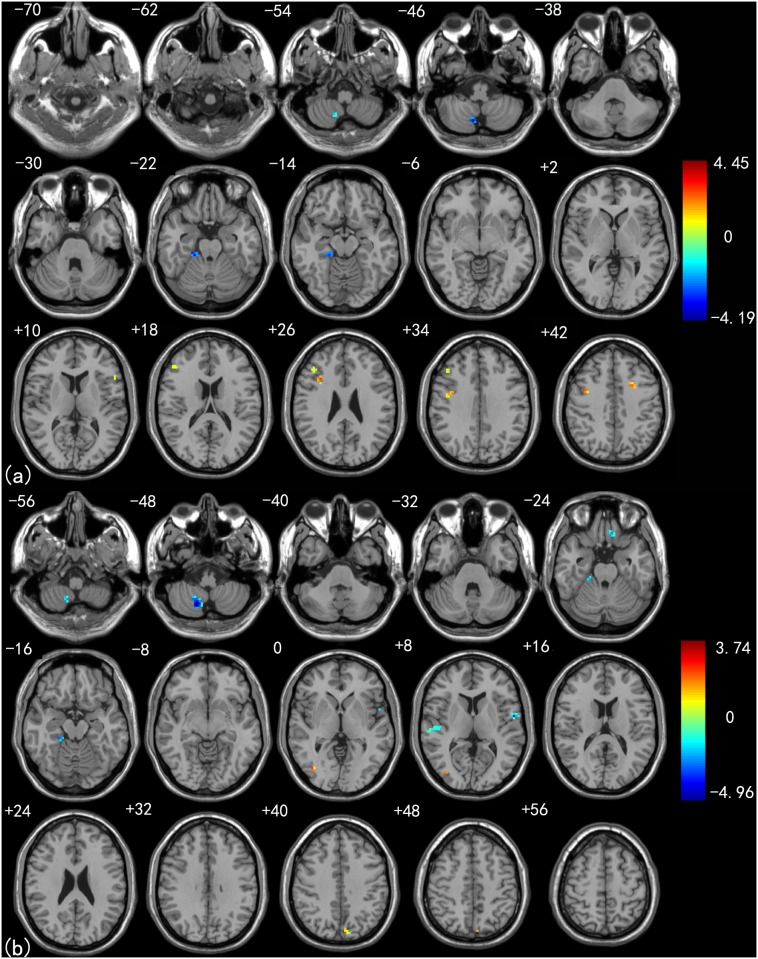 Fig 4