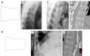 Figure 24