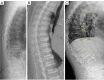 Figure 23