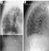 Figure 25