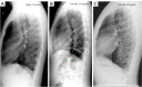 Figure 22