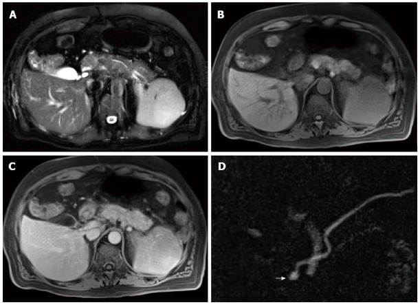 Figure 14