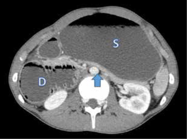 Figure 2.