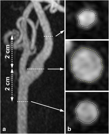 Fig. 2