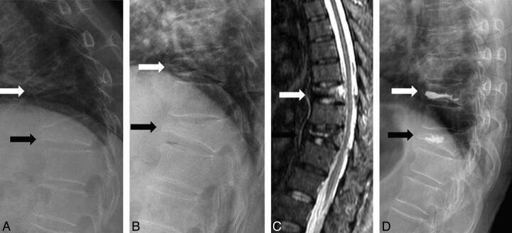 Fig 2.