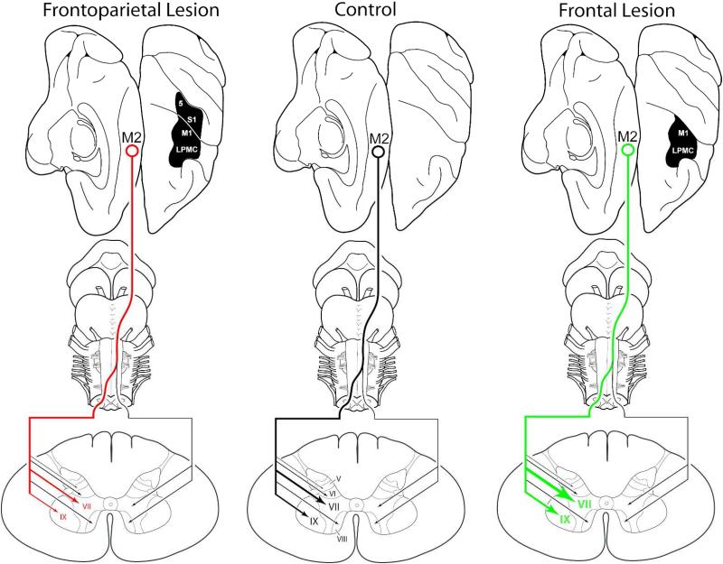 Figure 11