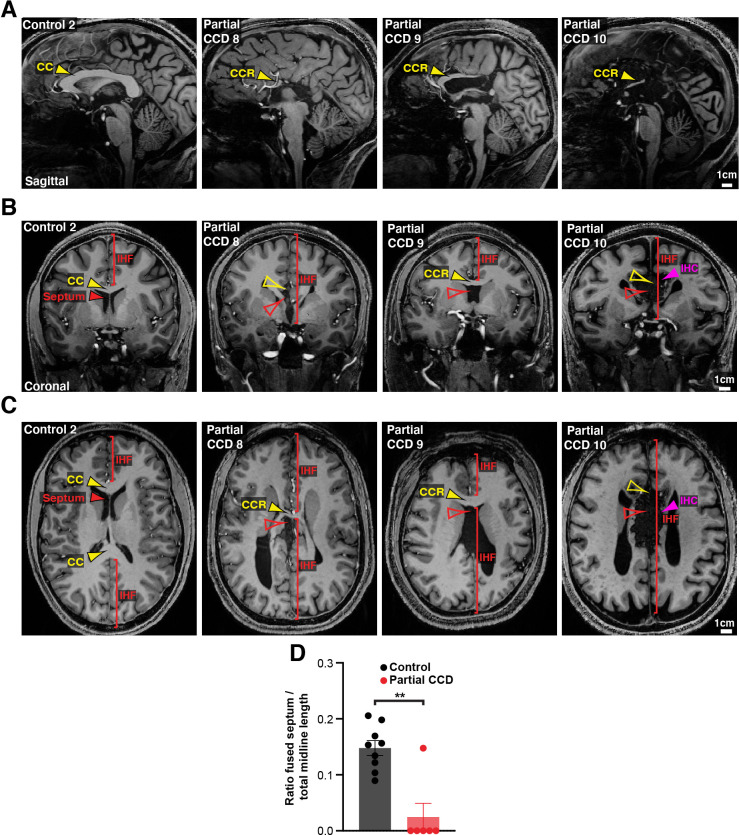 Figure 3—figure supplement 1.