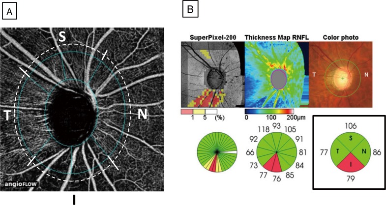 Fig 2