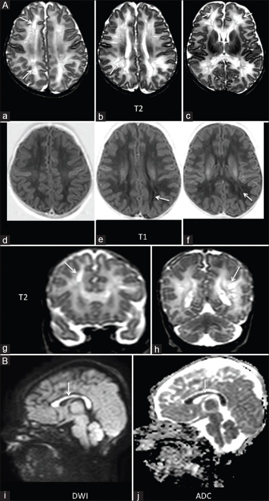 Figure 2 (A and B)