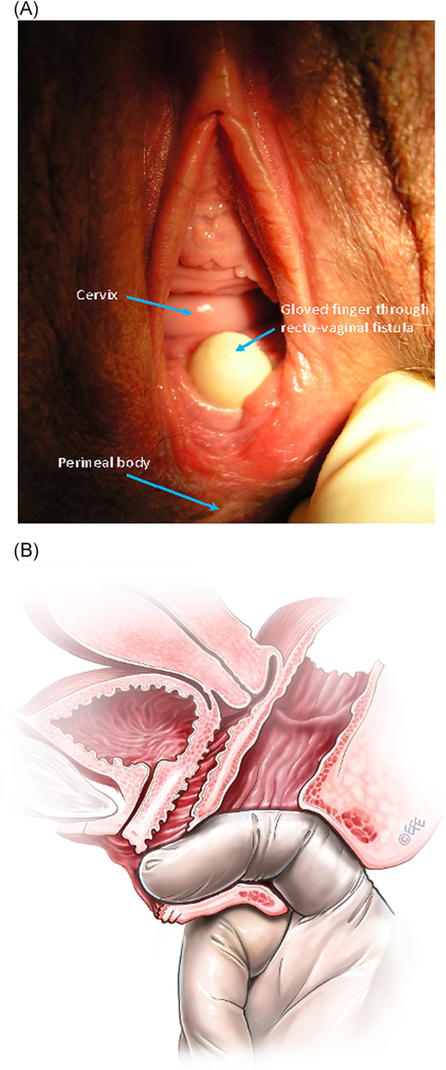 Fig. 3