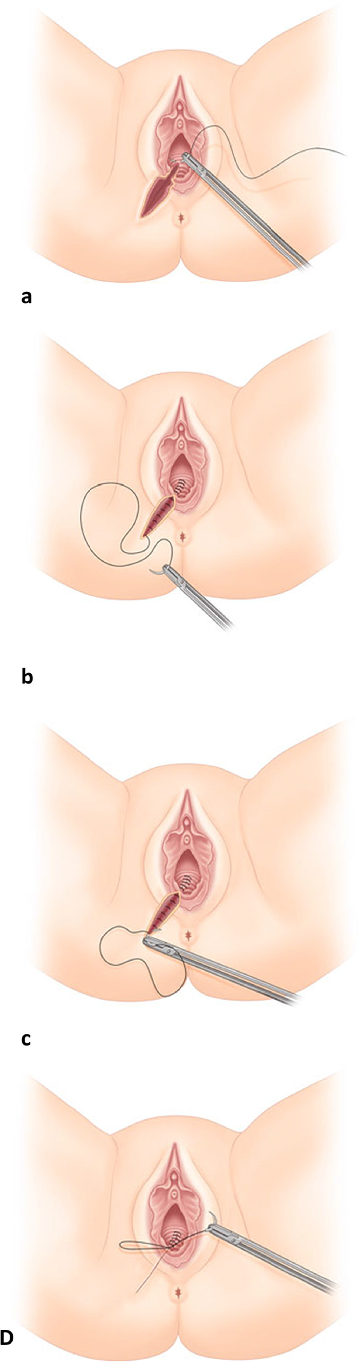 Fig. 23