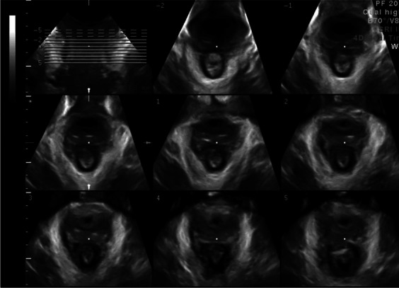 Fig. 7