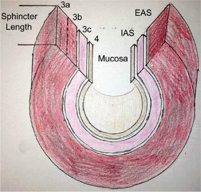 Fig. 12