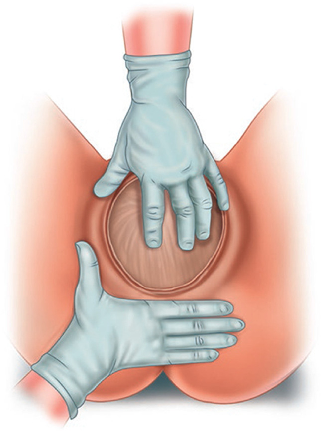 Fig. 17