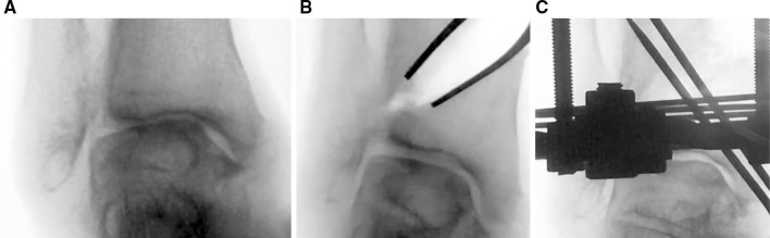 Fig. 5
