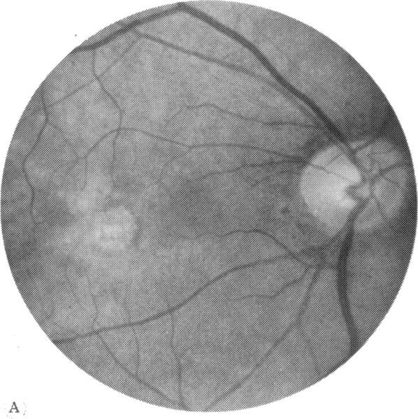 FIGURE 3 A