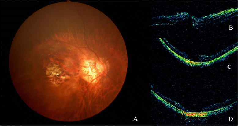 Fig. 1