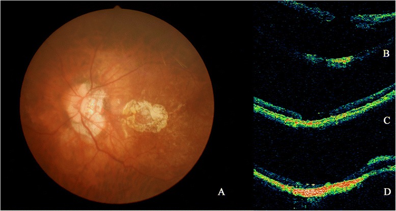 Fig. 2