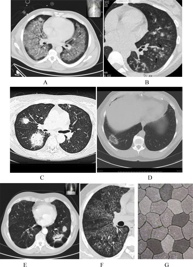 Fig. 5