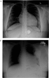 Fig. 1