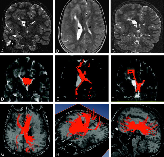 Fig 3.