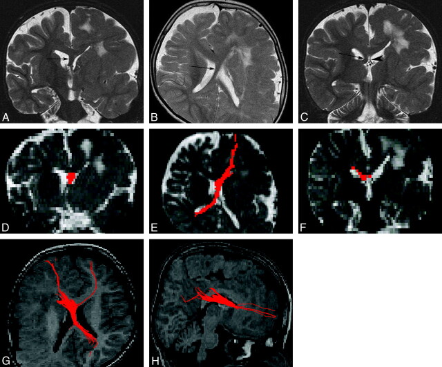 Fig 2.