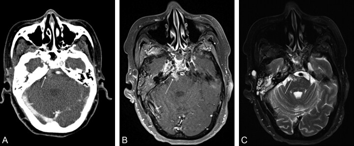 Fig 1.