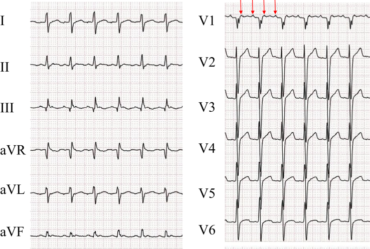 Figure 1