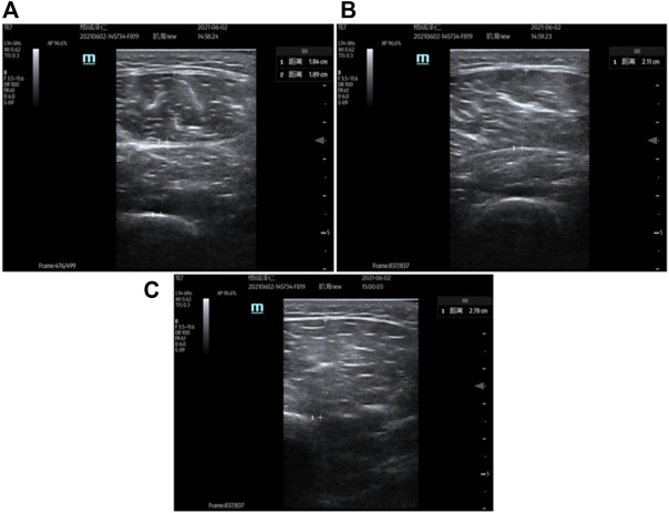 FIGURE 3