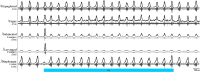 Figure 1—figure supplement 2.