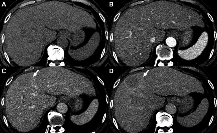 FIG 1