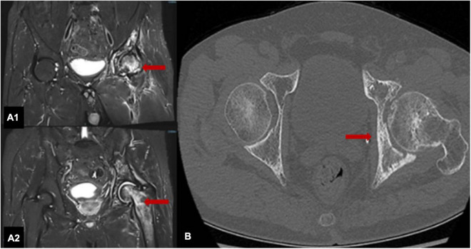 FIGURE 2