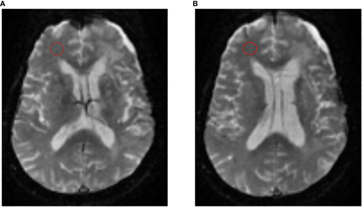 Figure 2