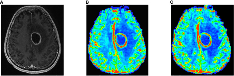 Figure 4