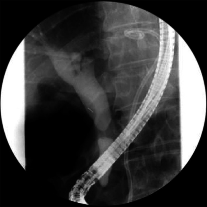 Fig. 3