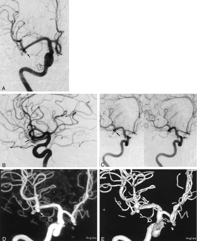 Fig 2.