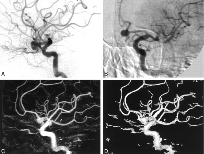 Fig 3.