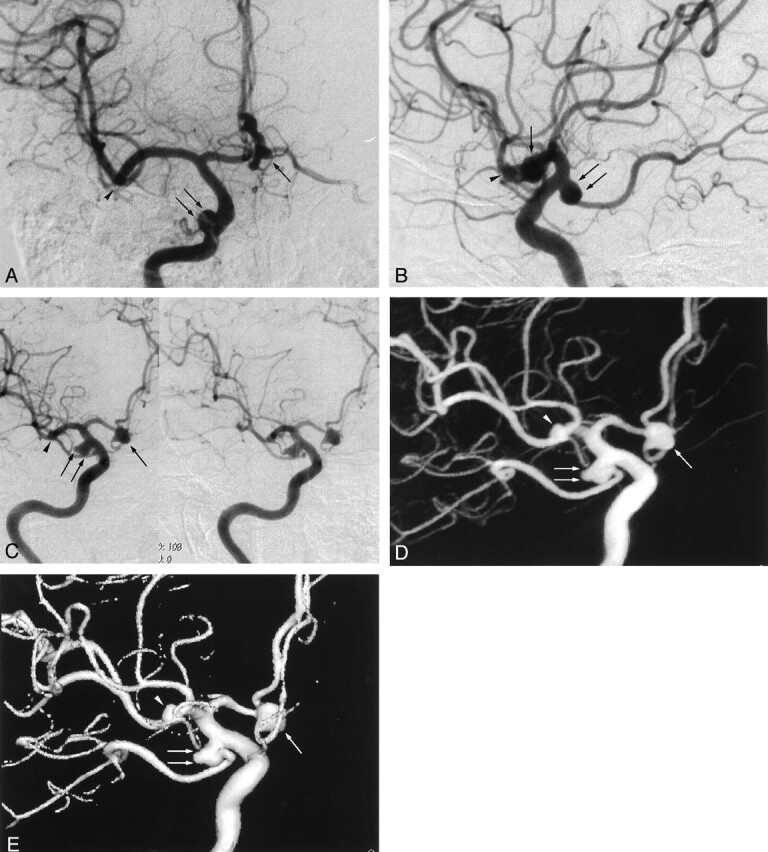 Fig 1.